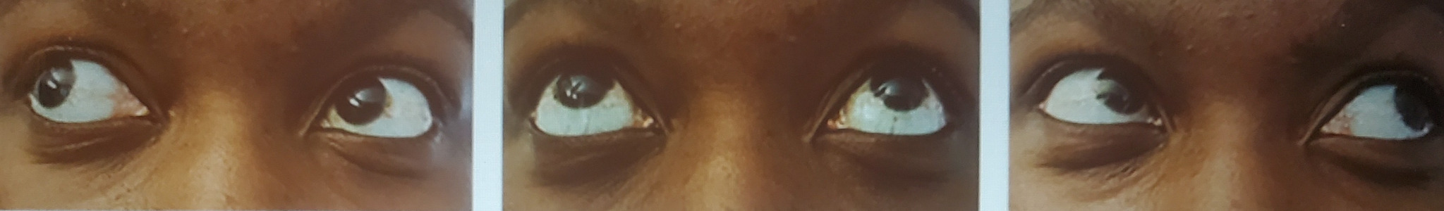 Three close-up views of eyes looking in different directions